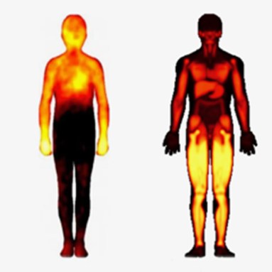 Two outlines of bodies shown next to one another feature varying patterns of orange highlights